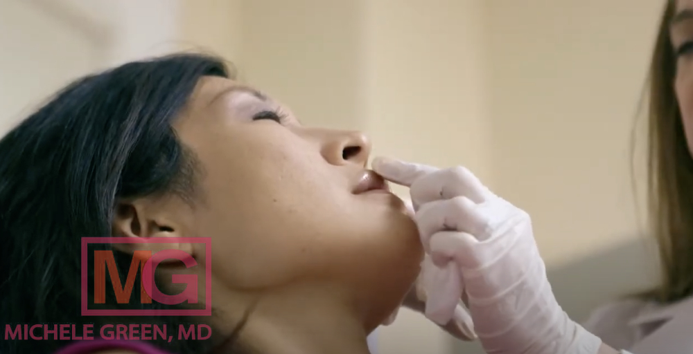 Lip Injection Treatments 3 MGWatermark
