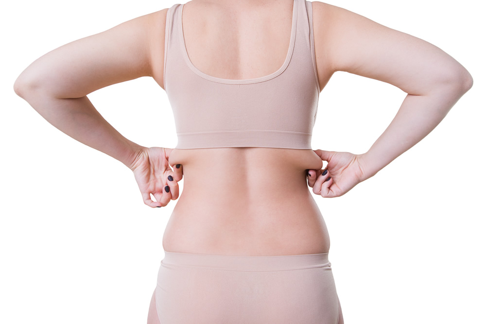 Bra & Back Fat Treatment Surrey