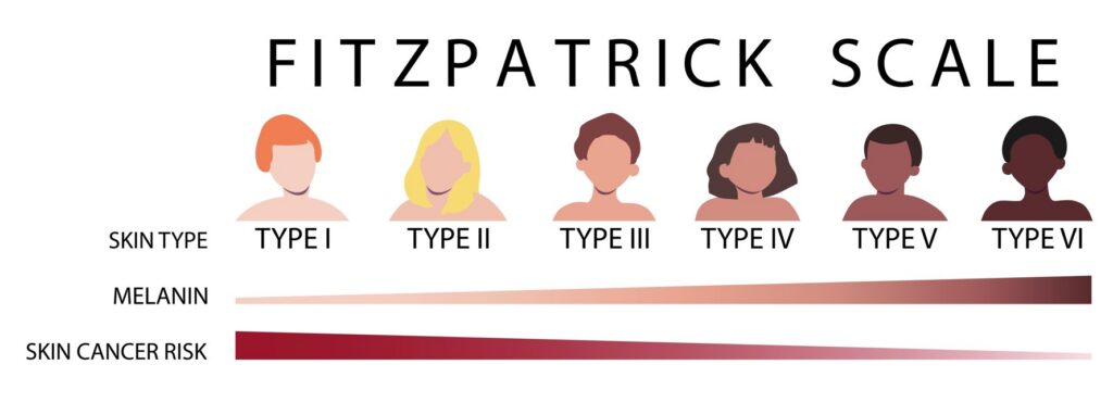 fitzpatrick skin types