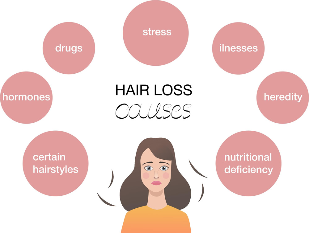 hair loss diagram of causes