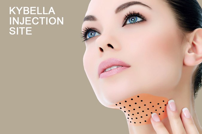 kybella grid