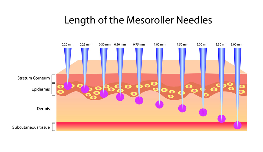 length meso roller1106555285