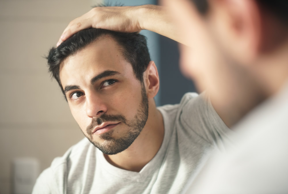 mens hair loss